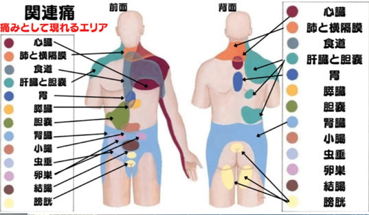 関連痛 痛みとして現れるエリア 前面・背面